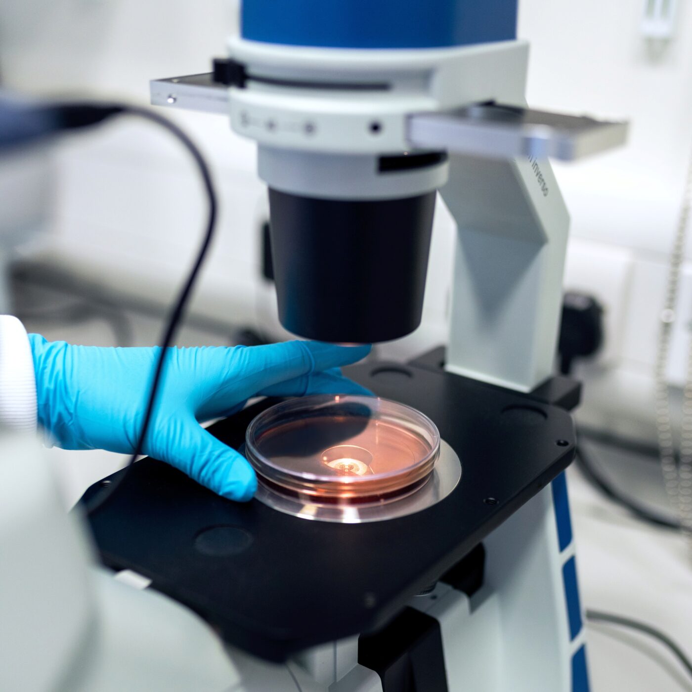 HCL : les « cellules médicaments », un espoir pour guérir des maladies incurables