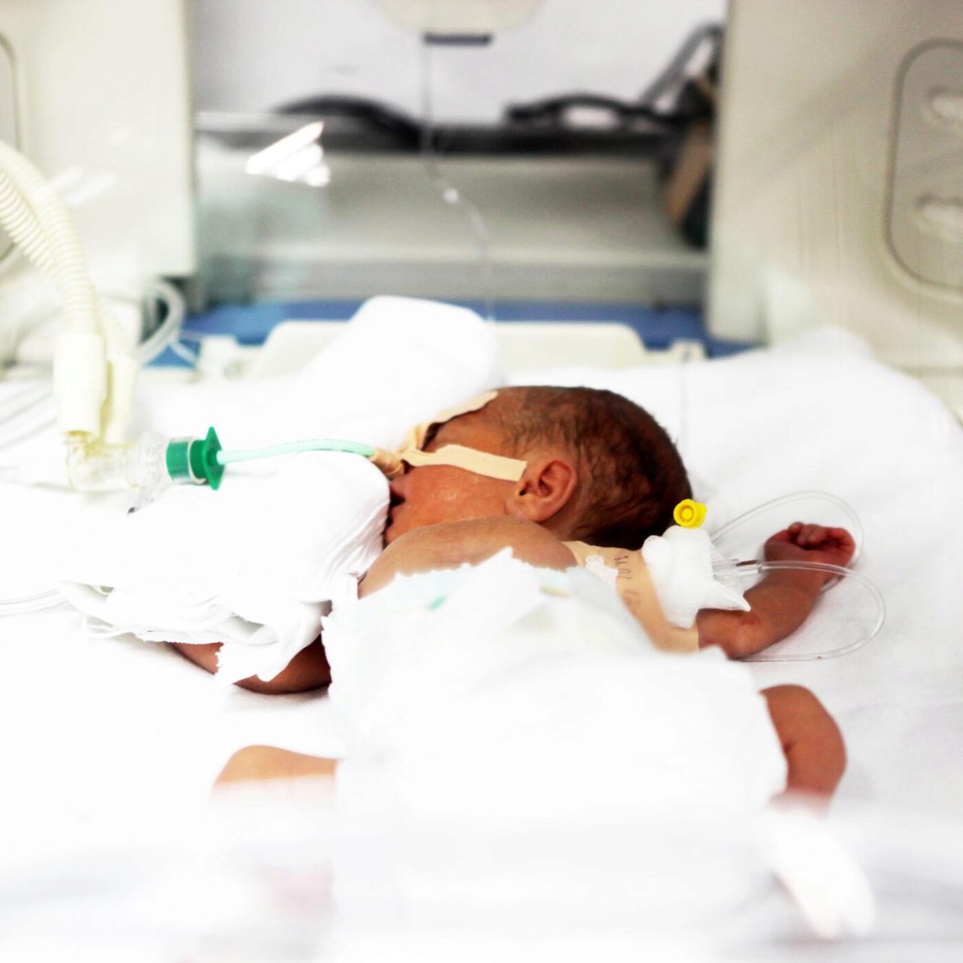 Néonatologie 1/5 - Les montagnes russes