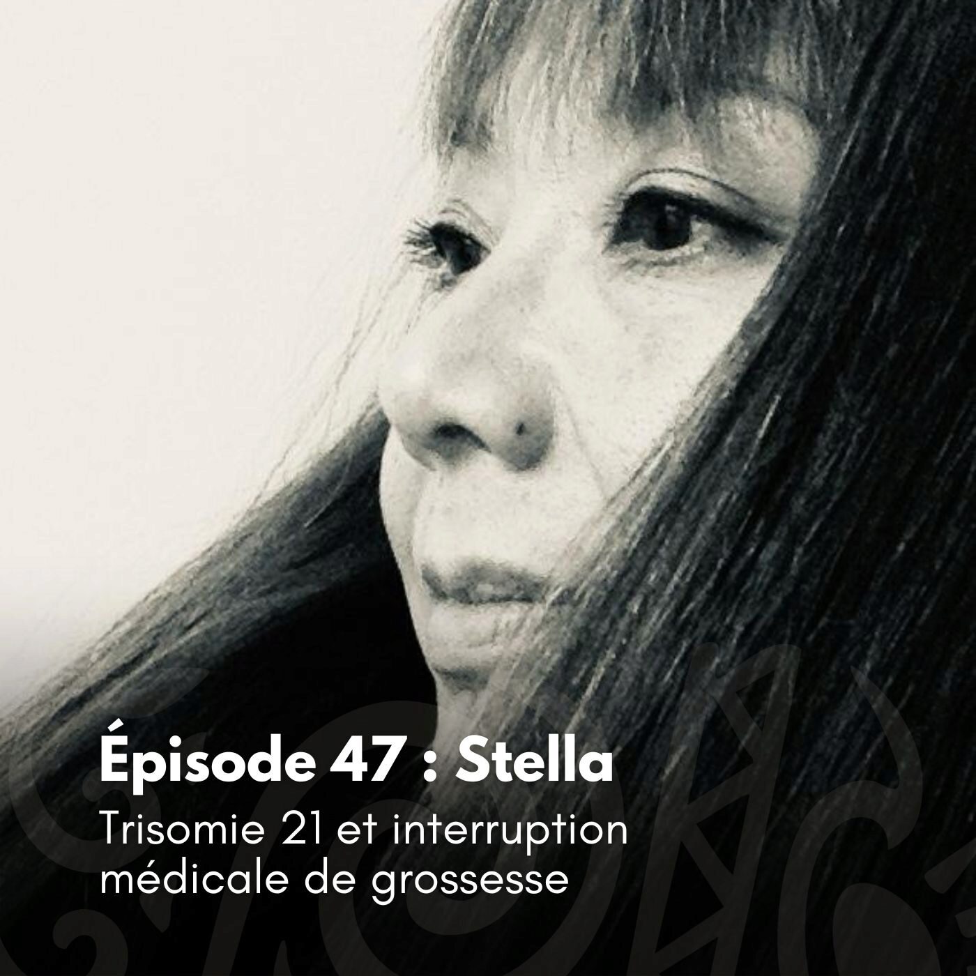 # 47 - Stella : Trisomie 21 et interruption médicale de grossesse episode artwork