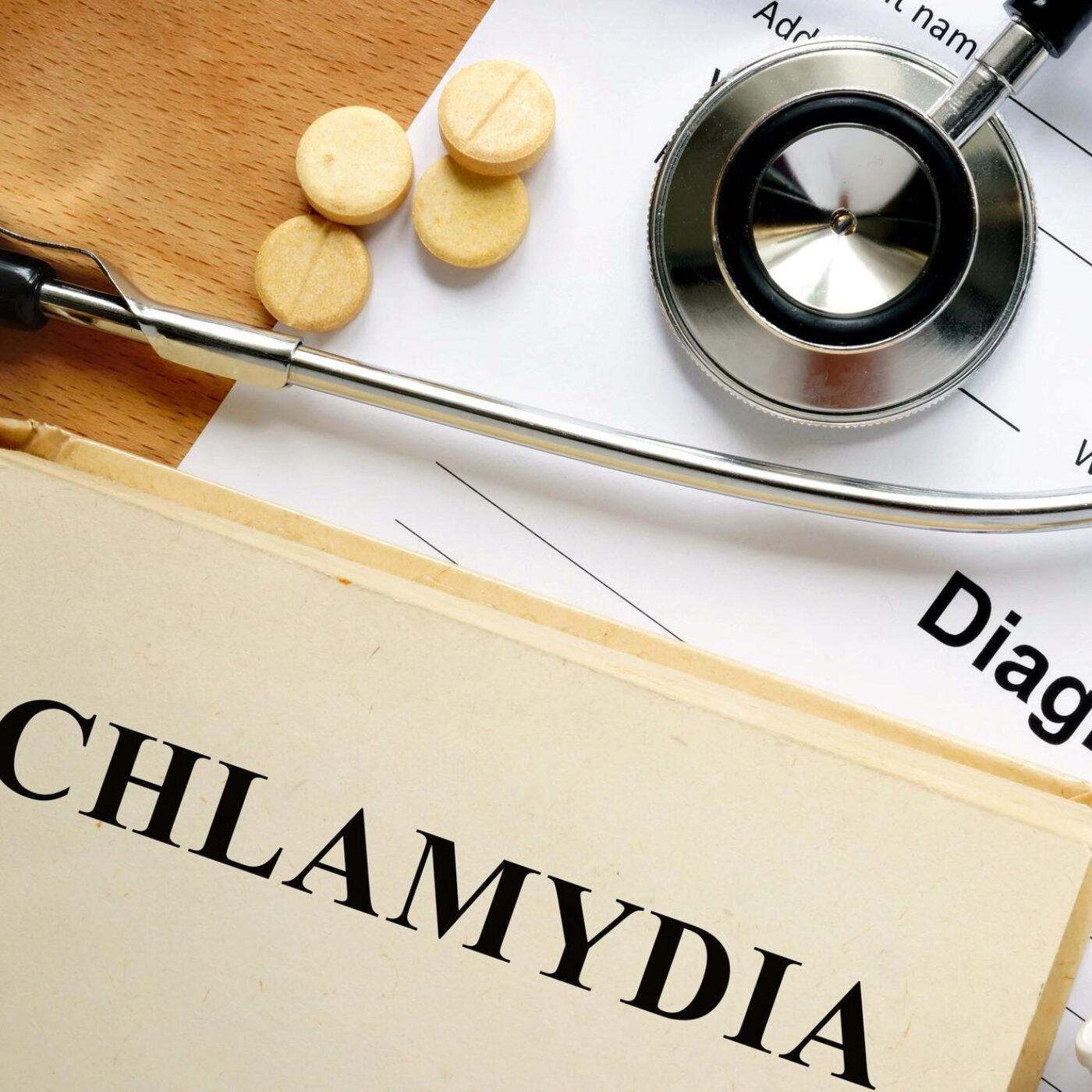 Le TDAH dans la sexualité, les dépressions atypiques, l'arithmétique modulaire et la salutation chez les éléphants