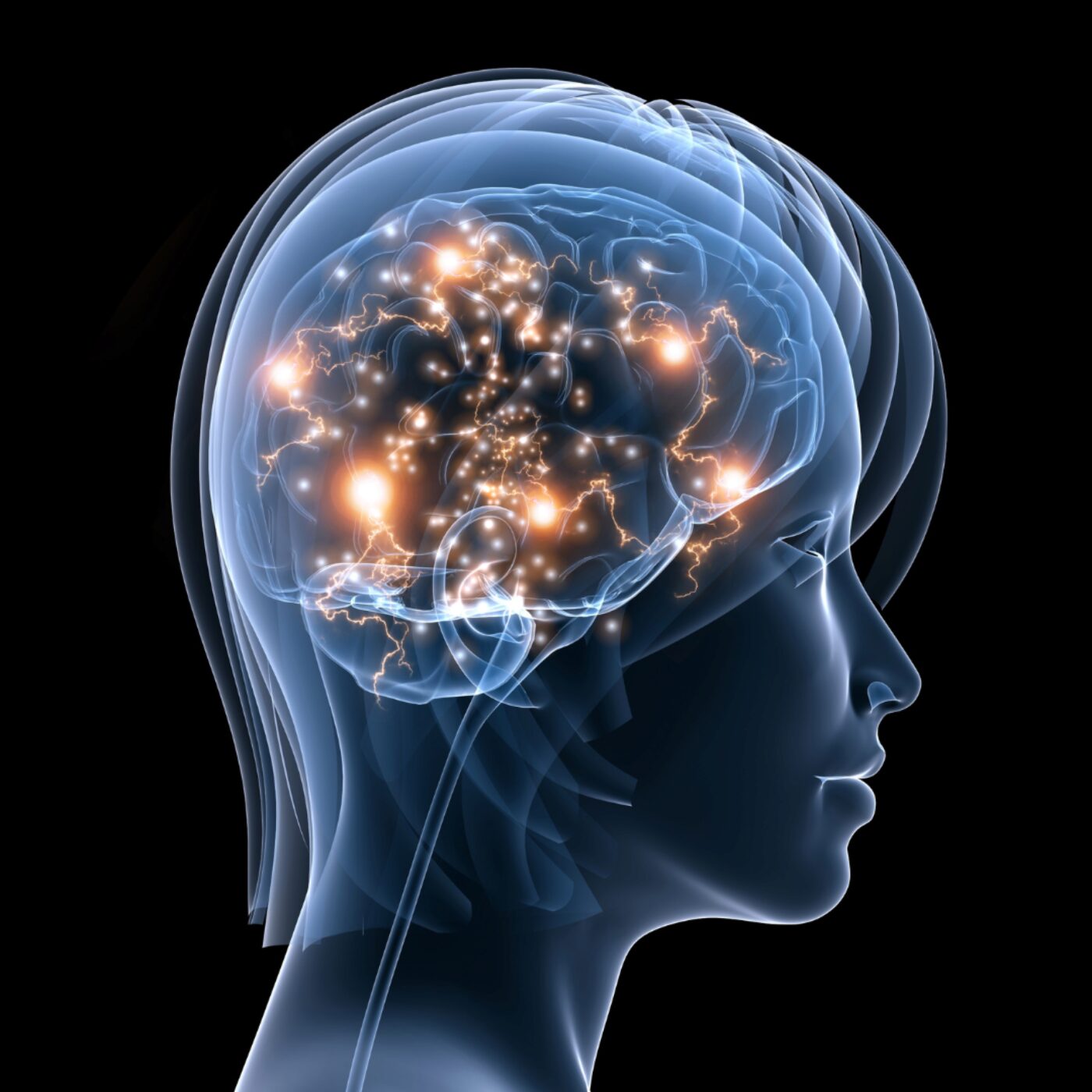 Striatum, Striatum, est-ce que j’ai une tête de striatum episode artwork