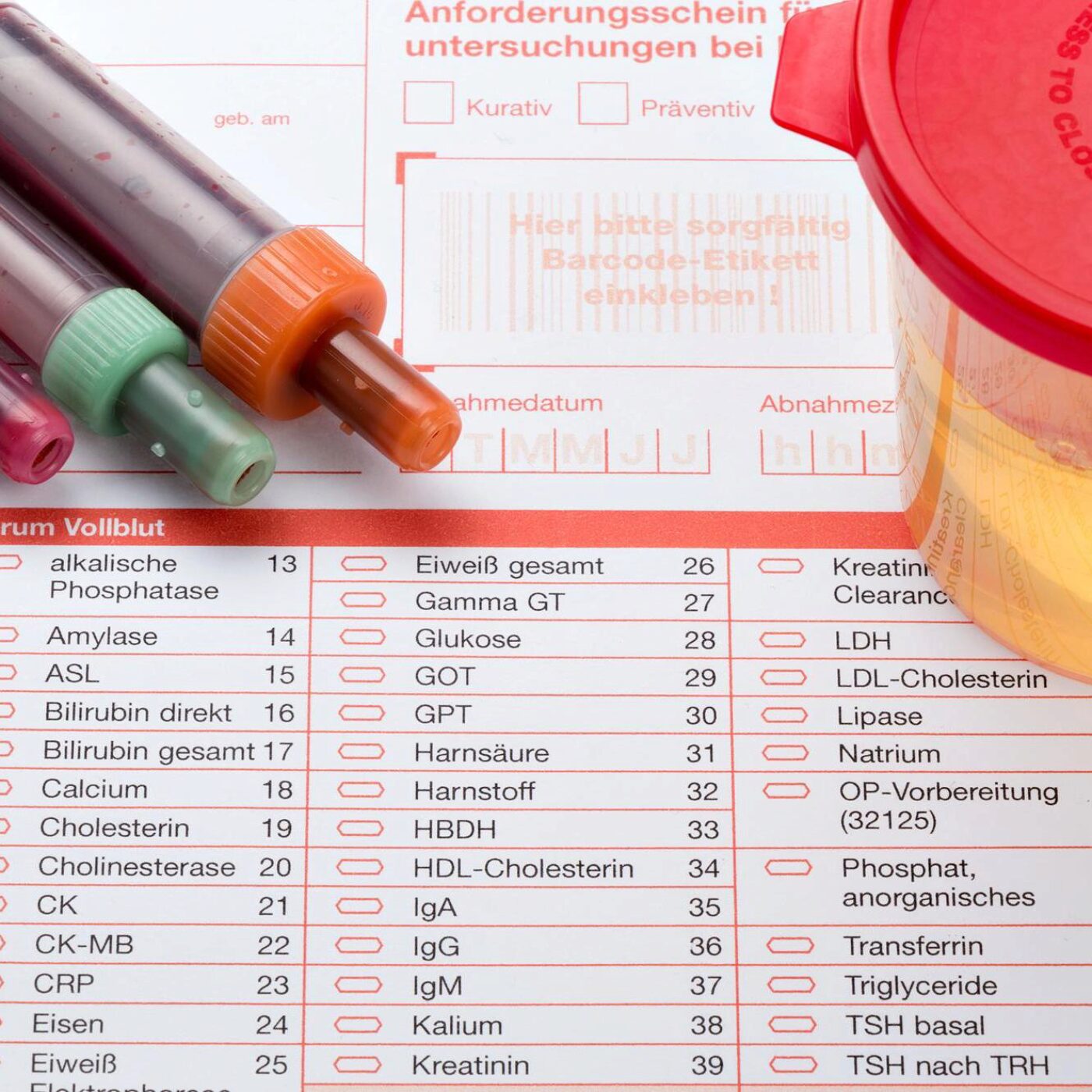 Le dopage, des crottes d'animaux et la Ritaline