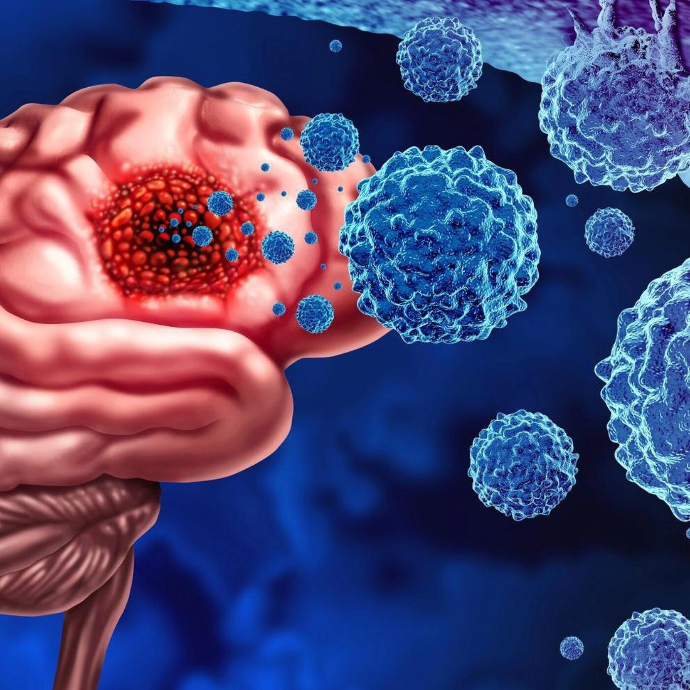 Le cancer du cerveau, les tortues marines et les cernes des arbres