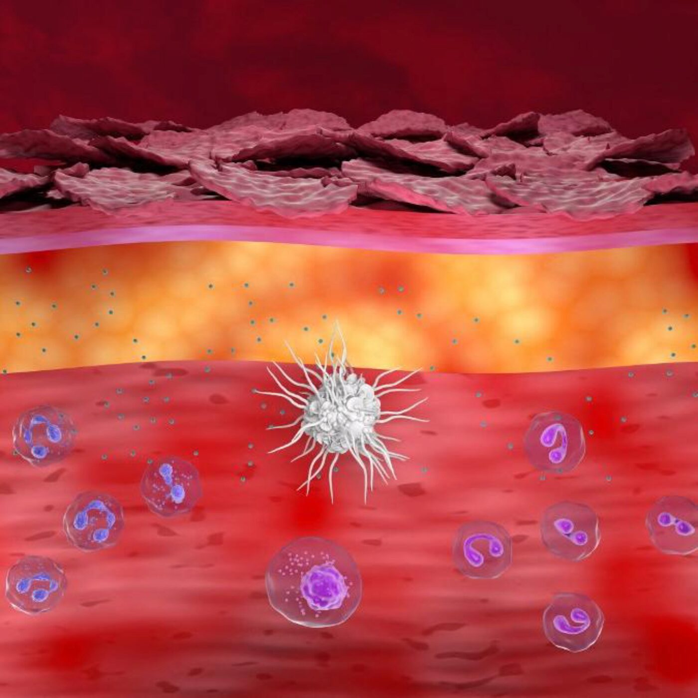 Le stress dans l'eczéma, des mâles alphas mis à mal et des levures façonnées