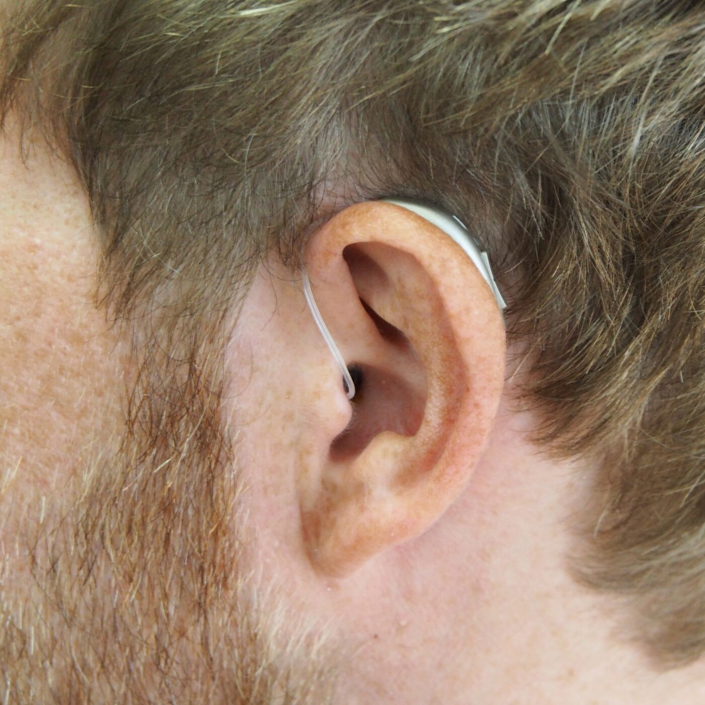 La chronique santé de la Fondation HCL · RCF Lyon