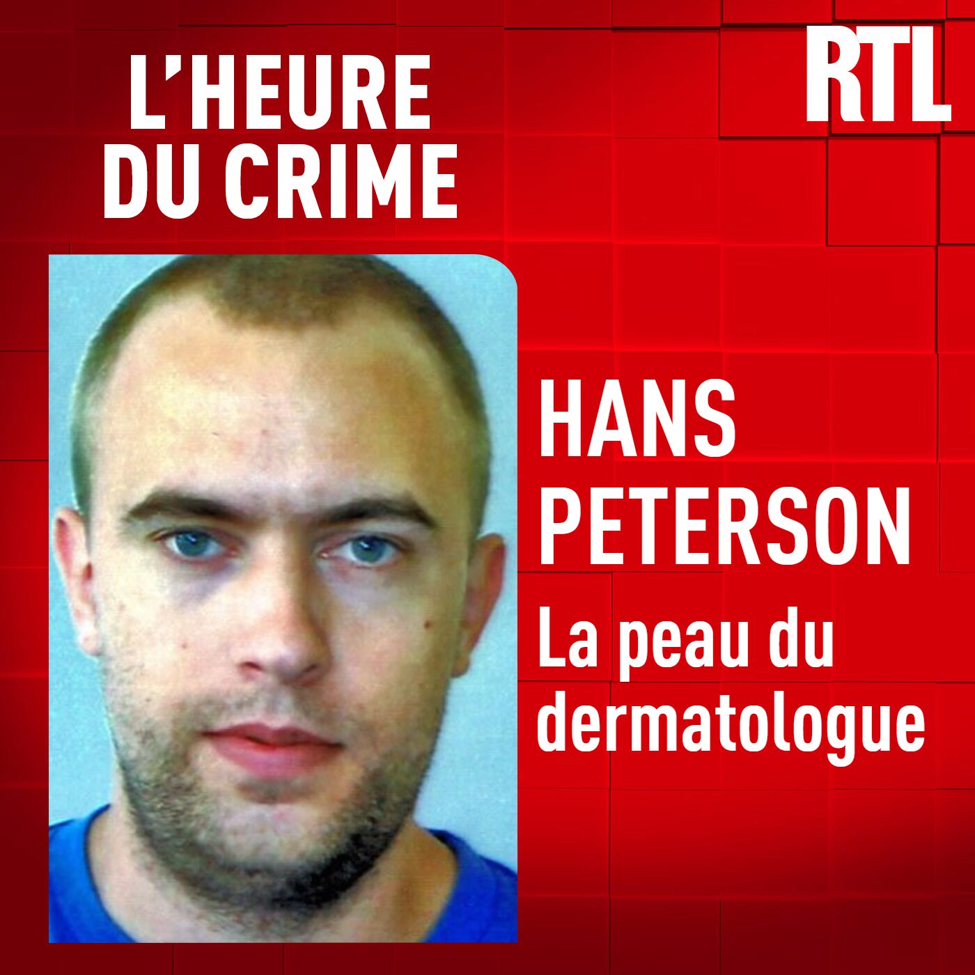 L'INT&Eacute;GRALE - Hans Peterson : la peau du dermatologue