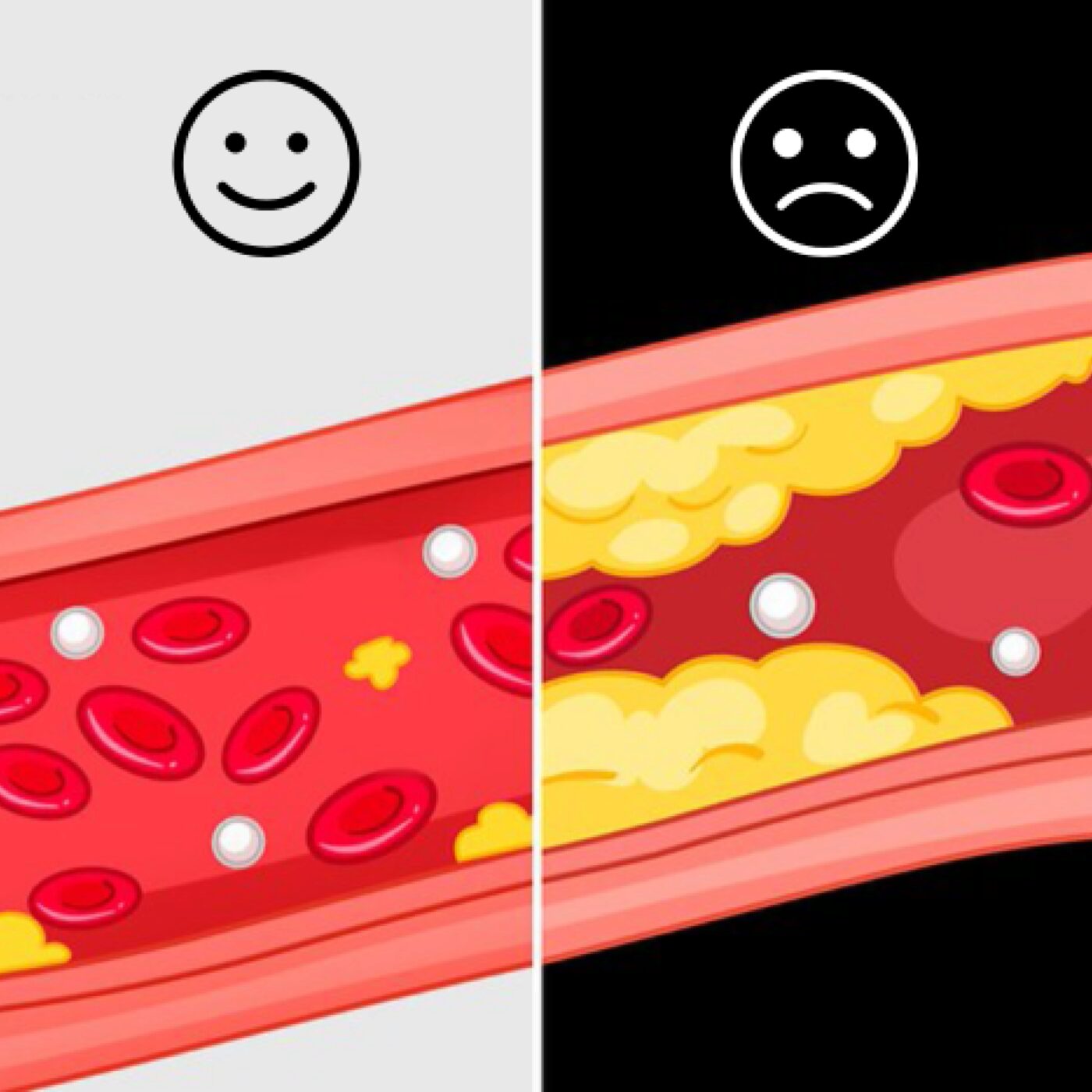 Eurêka · RCF Alsace