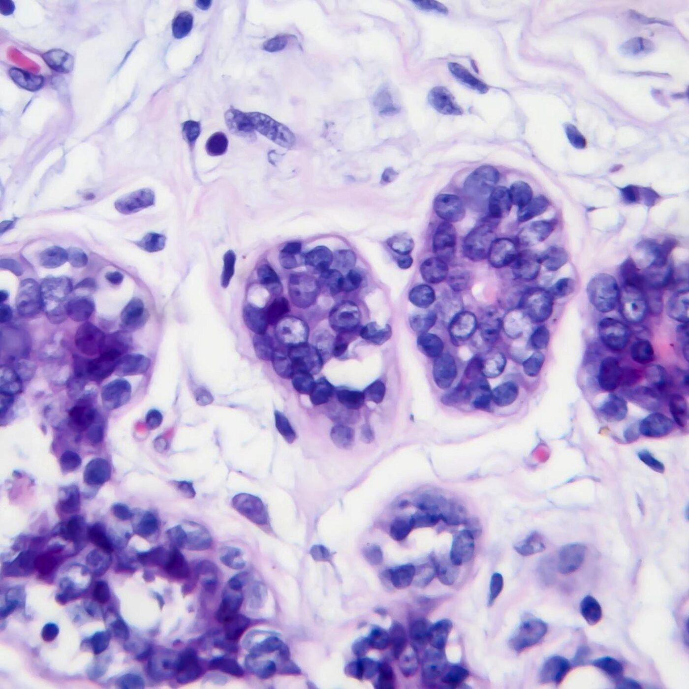 Prédire le risque de métastases, la stylométrie et des membres qui repoussent