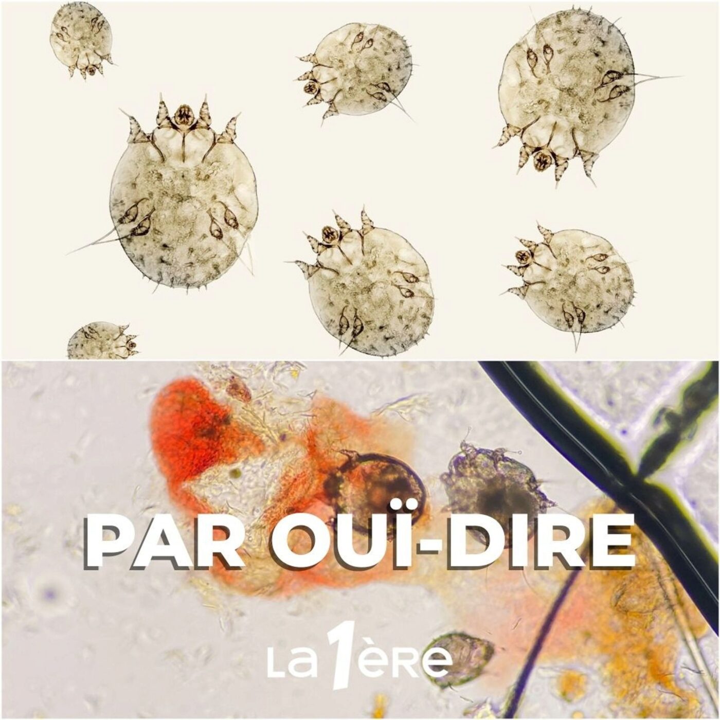 La gale, une vieille maladie en recrudescence ?