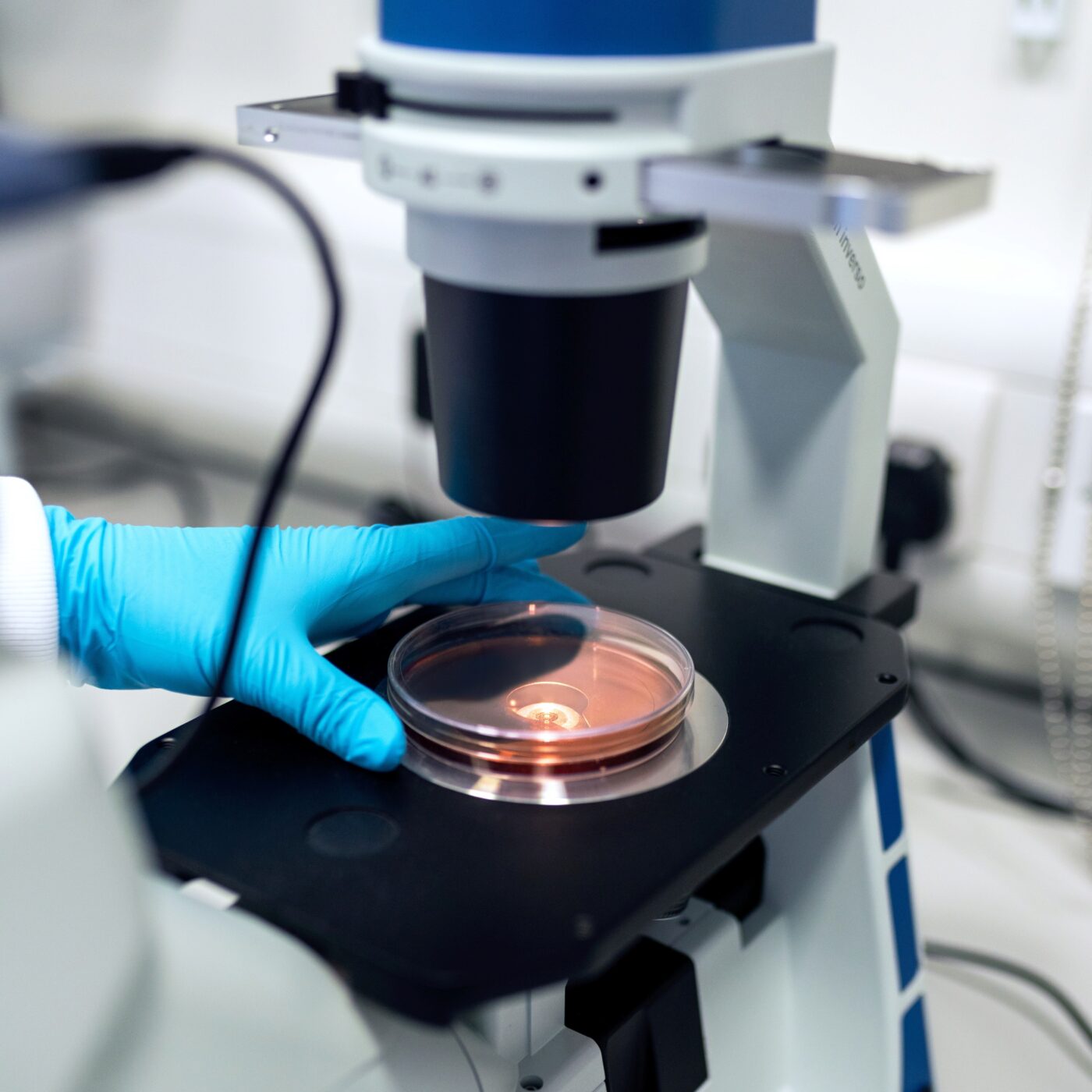 La recherche progresse contre l'antibiorésistance