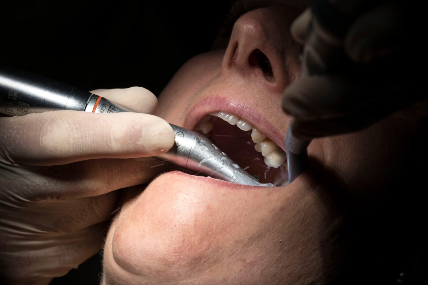 Hépatites, VIH... Un dentiste soupçonné de ne pas respecter les règles d'hygiène : à Cherbourg, 2.800 patients invités à se faire dépister episode artwork